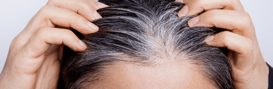racines de cheveux blancs