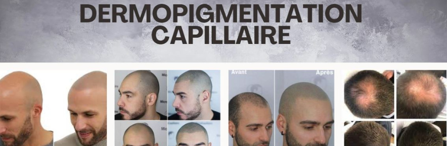 dermopigmentation capillaire