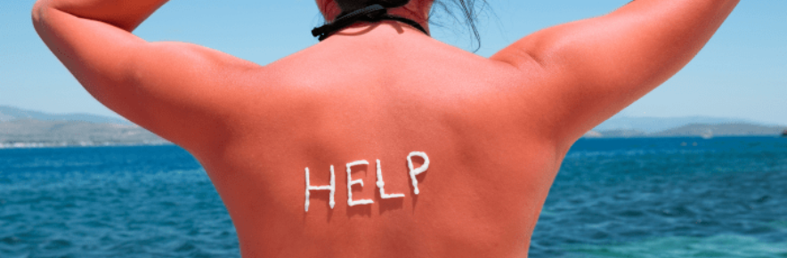 Nos astuces pour soulager les coups de soleil