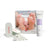 Calluspeeling Refill Kit 30 Treatments